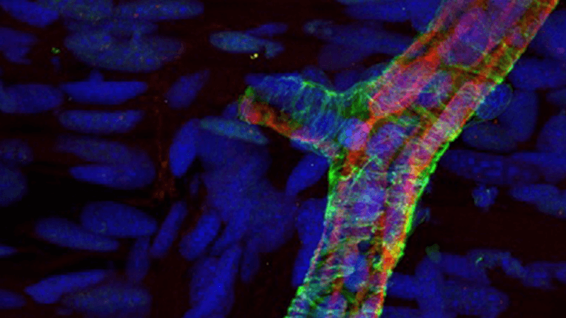 Microscopy image of limb regeneration