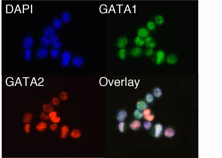 Four brightly stained groups of cells on a black background