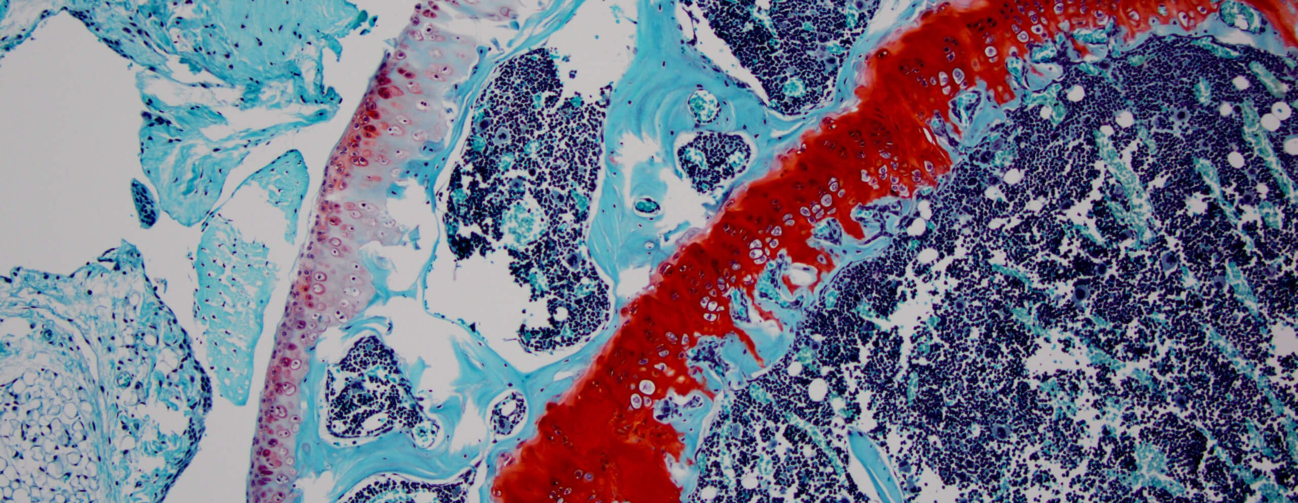Histology image showing stained bone tissue: streaks of red through blue and cyan blobs