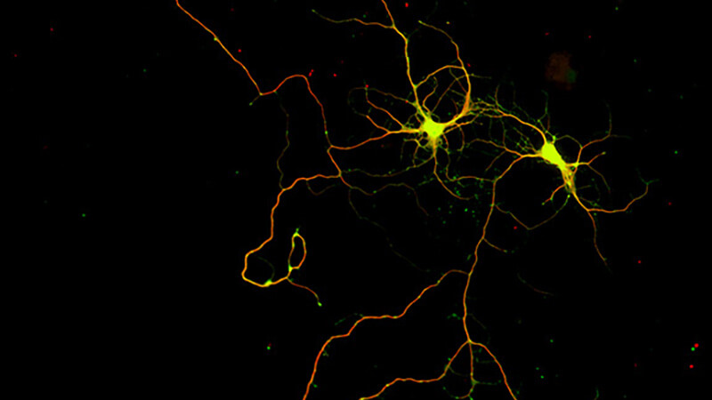 endogenous neurogenesis