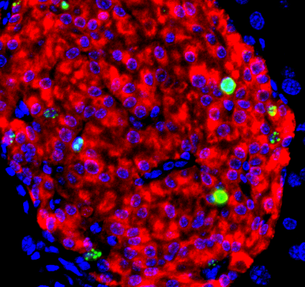 Image of beta cells: bright red and blue blobs