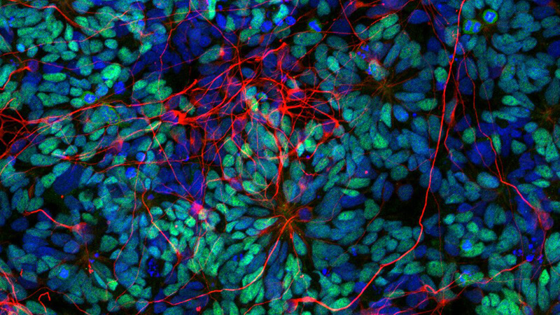 directed differentiation of pluripotent stem cells