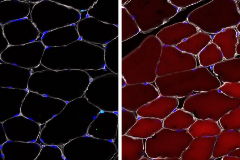 Before and After image of cells