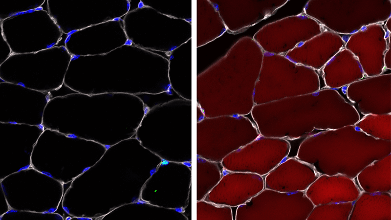 Before and After image of cells