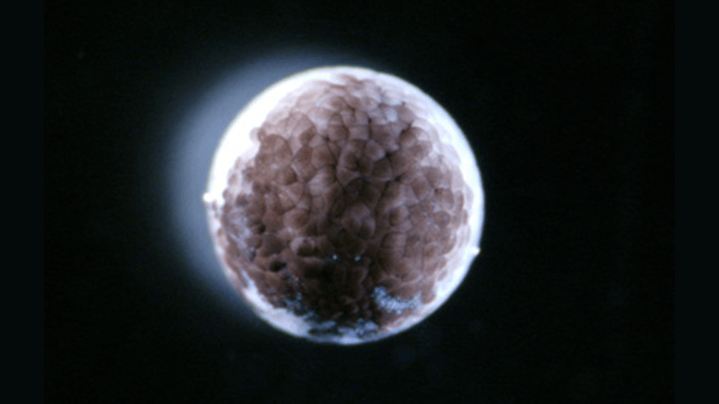Microscopy image of an axolotl blastema