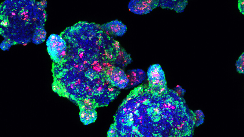 Microscopy image of three beta cells: green, purple, red dots against a black background