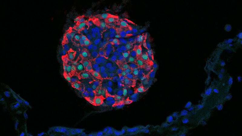 Beta cells: red and blue against a black background
