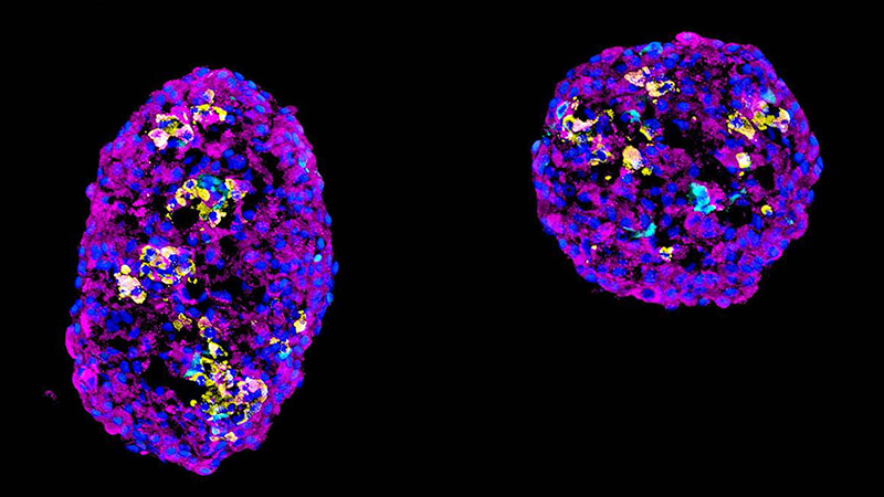 Microscopy image of two beta cells, purple with blue and yellow dots
