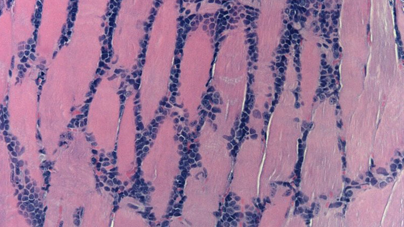 Image of cells under the microscope, pink and purple