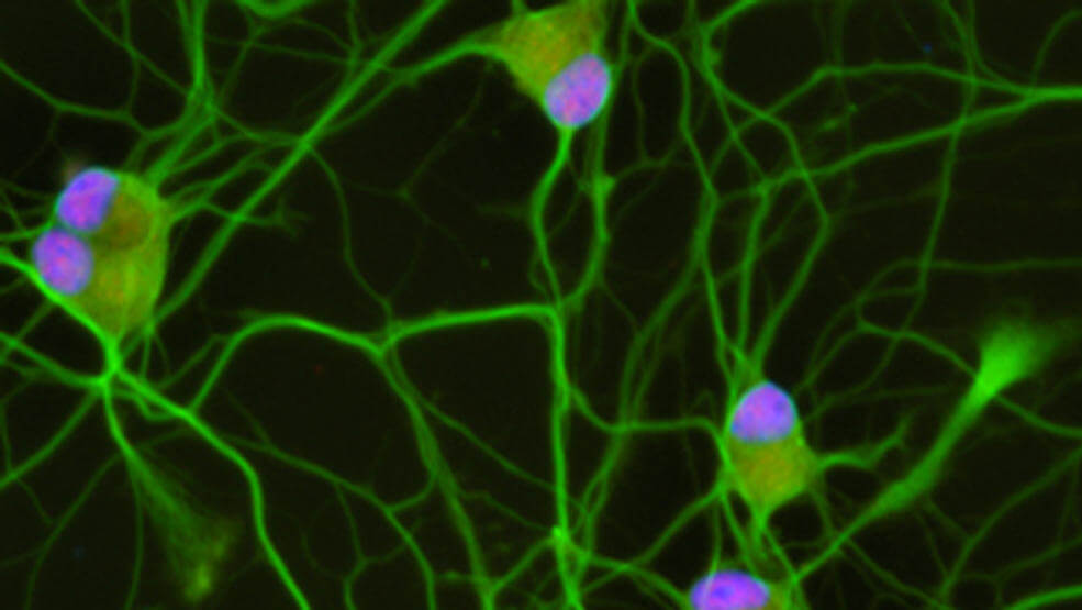 microscopy image of neurons