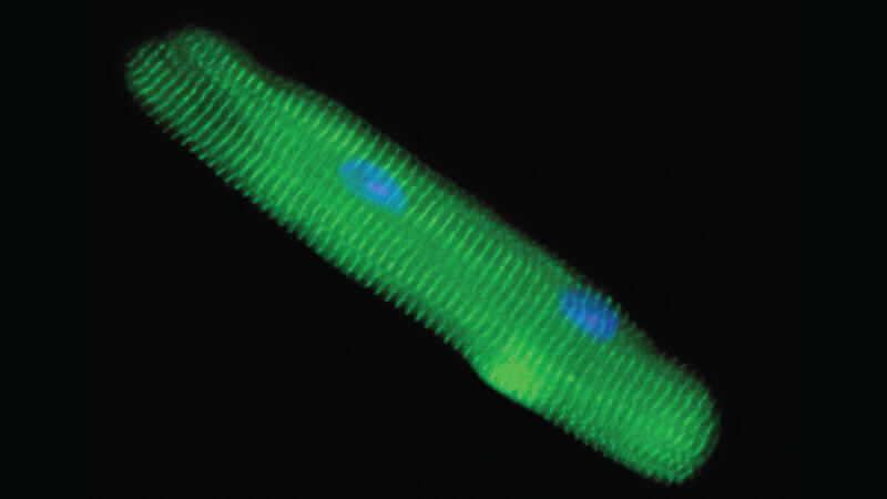 fluorescent image of cardiomyocyte