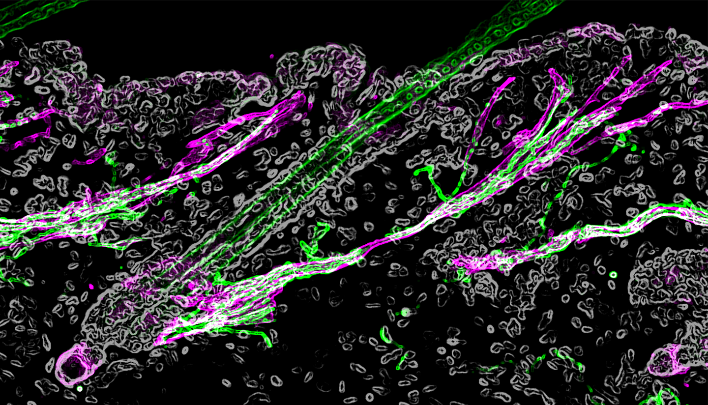Microscopy image of hair follicle.