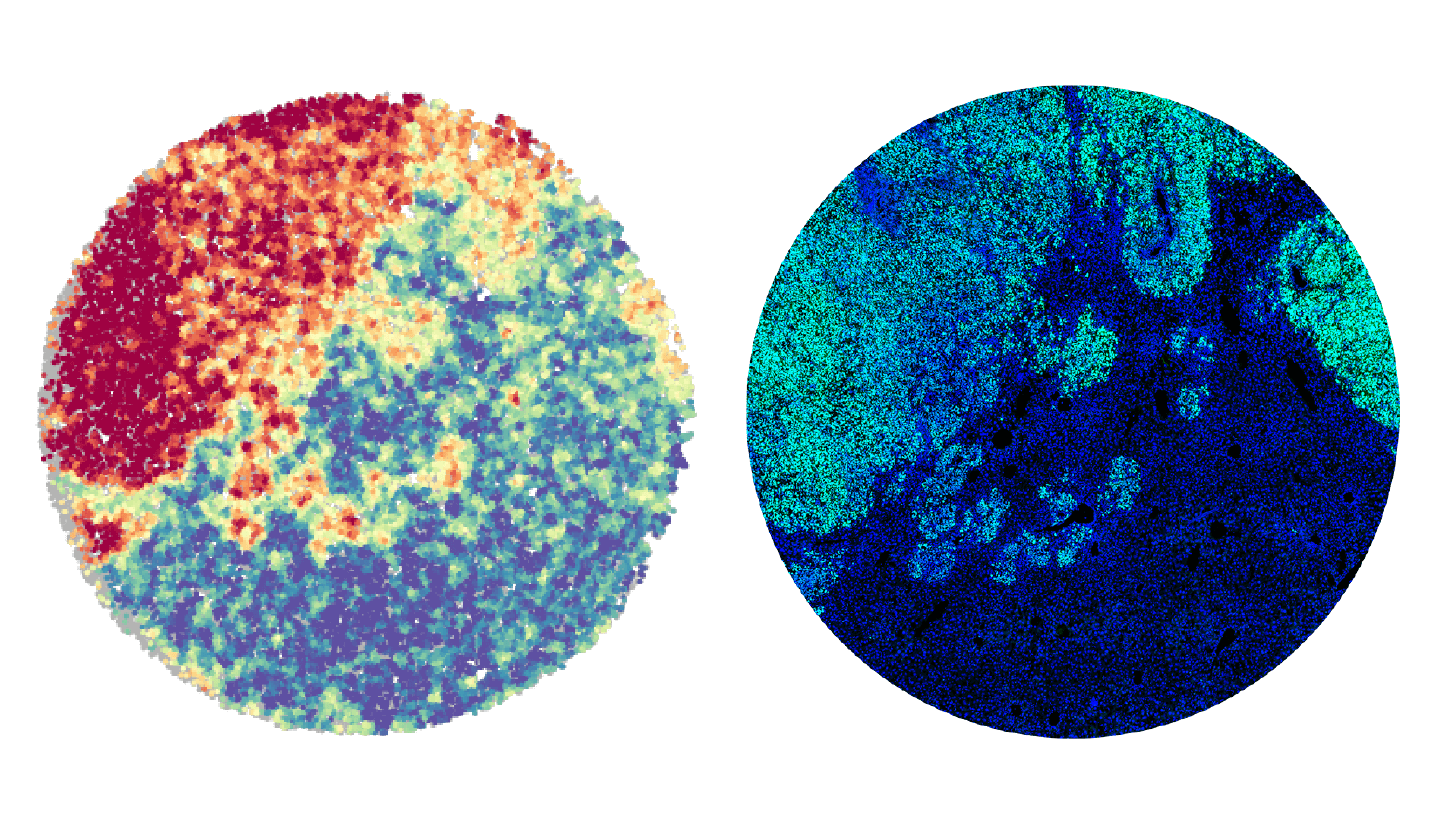 Two panels showing the same cross-section view of a tumor.