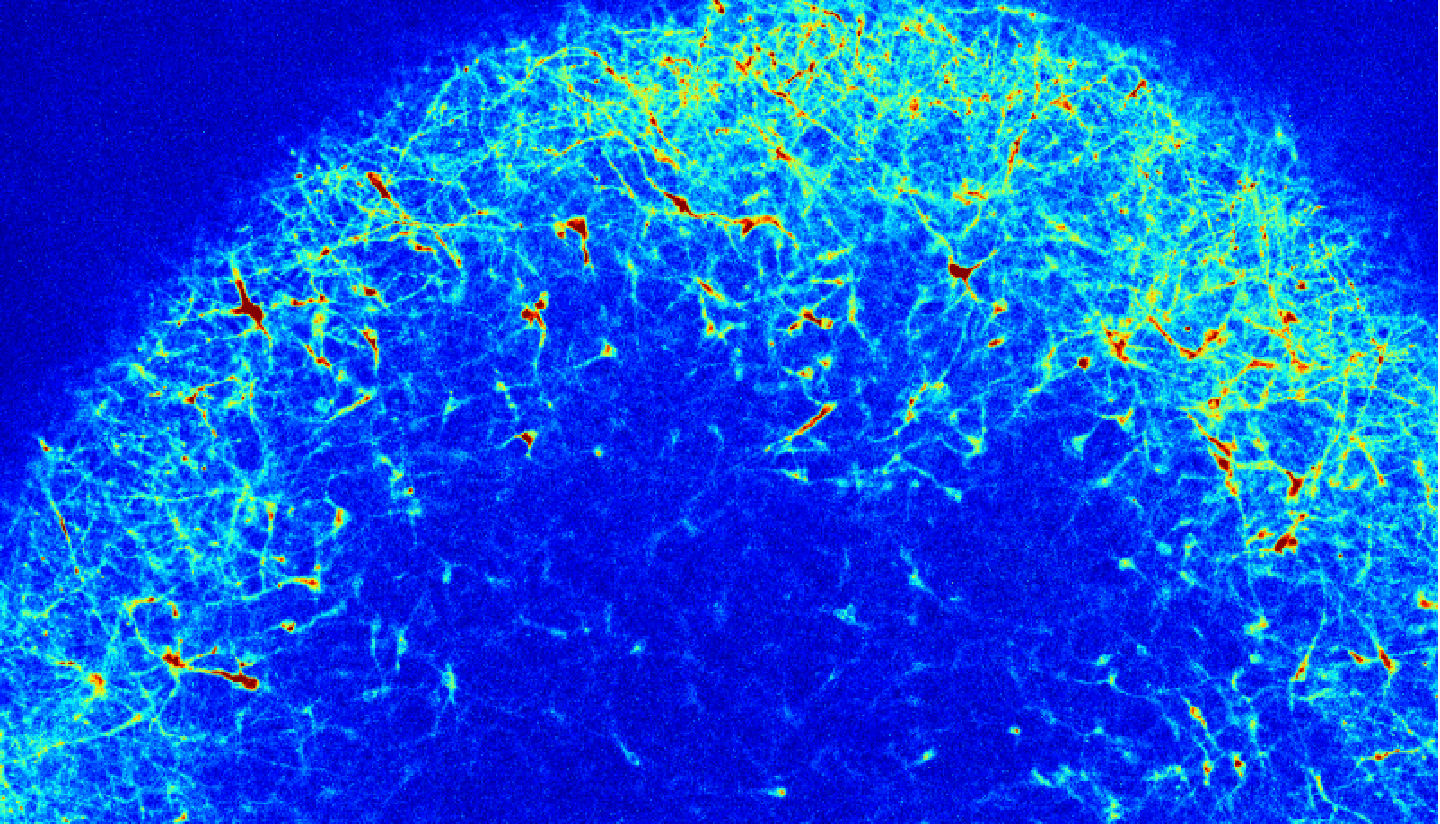 Microscopy image showing a network of individual neurons, with projections connecting to each other.