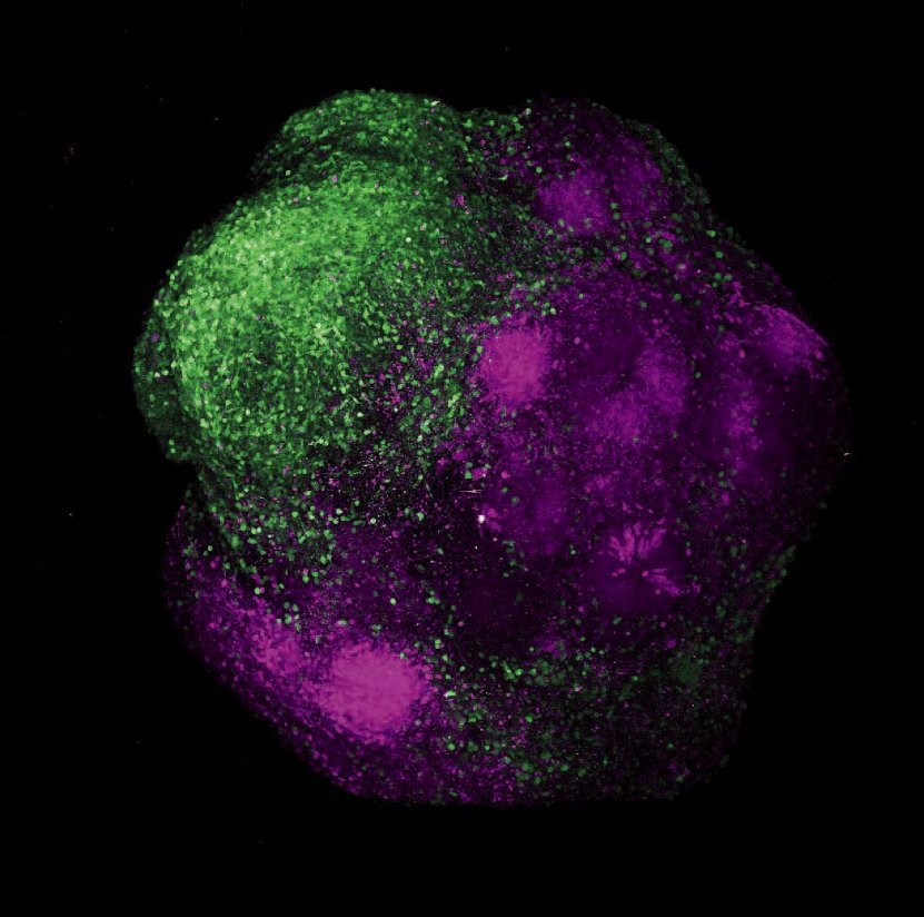 Human brain organoids showing the integration of excitatory neurons (magenta) and inhibitory neurons (green) of the cerebral cortex