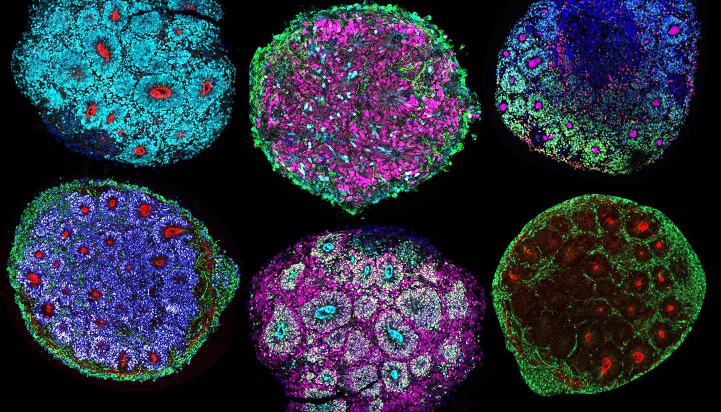Colorful slide display of six brain chimeroids