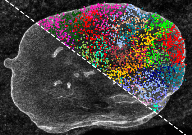 Greyscale microscopy image overlay with color dots.