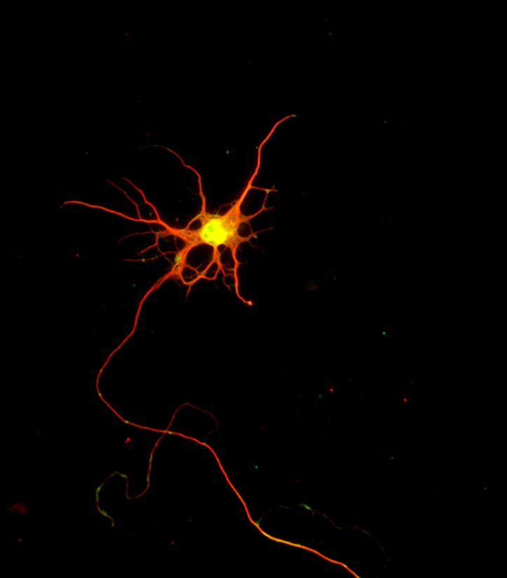 A lab-grown neuron bright yellow-orange center with reddish-orange 