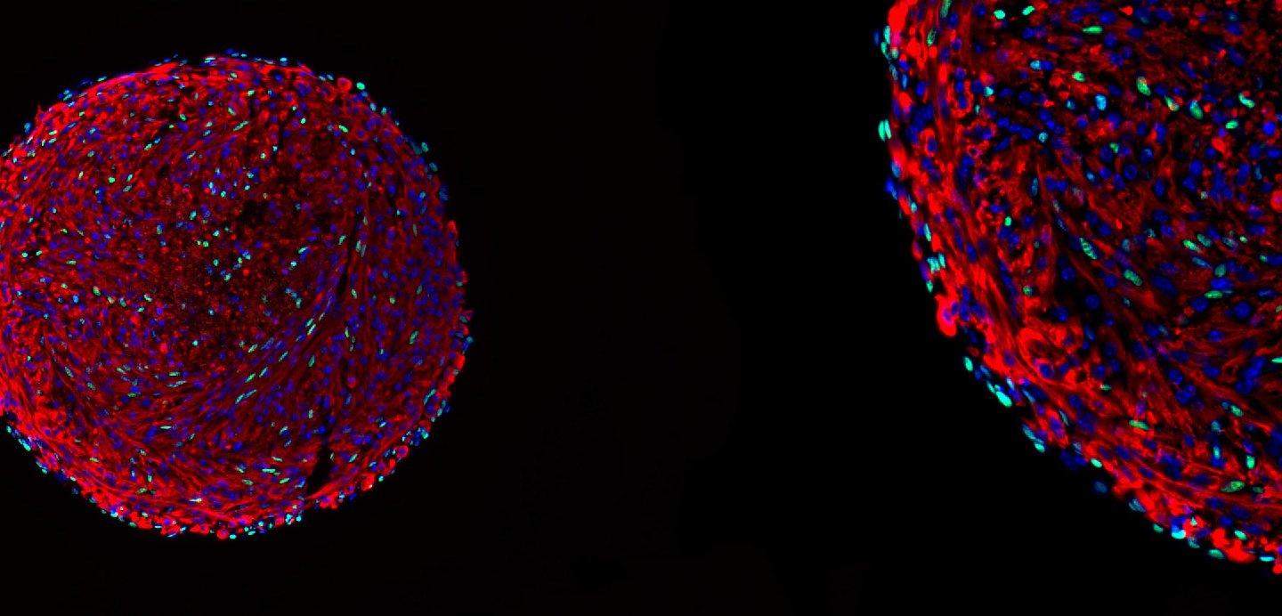 Microscopy image of a skeletal muscle organoid. Colorful, predominantly red orbs